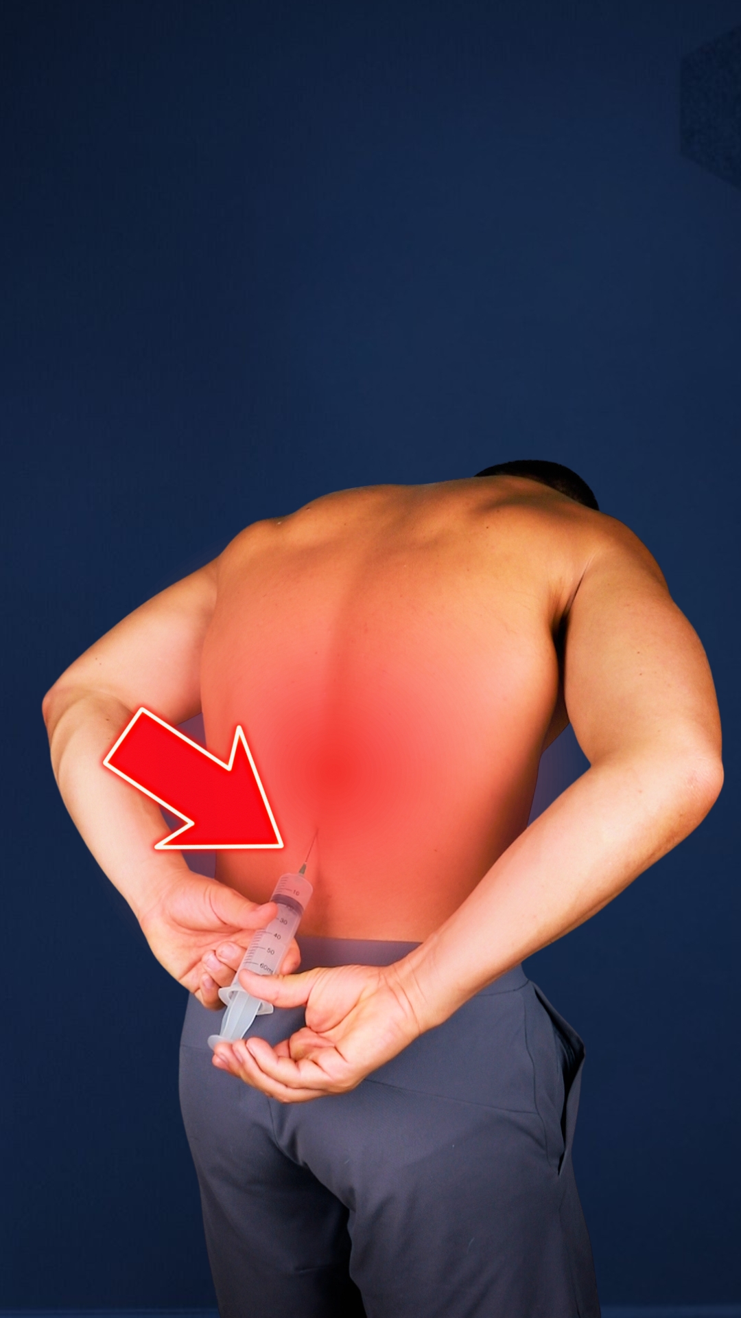 💥 Stop Getting Injections — Start Fixing Your Back! If your lower back ...