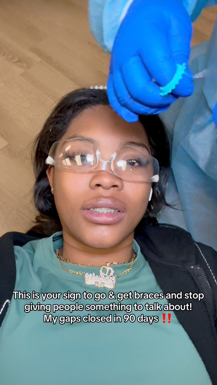 you been thinking about going to get braces, this is your SIGN to goooo ...