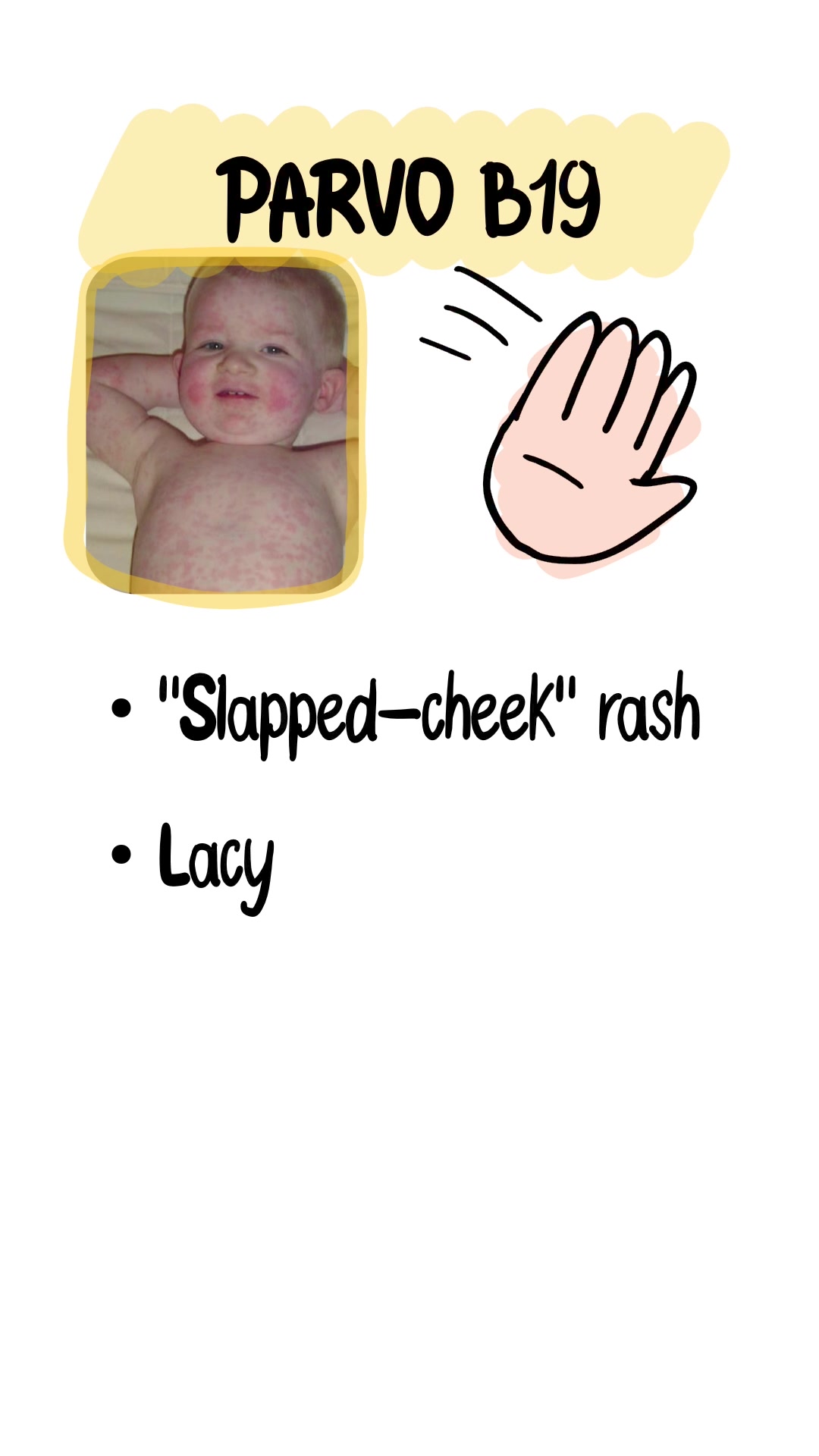 Pediatric Rashes — See the Pattern, Get the Points Measles (Rubeola ...