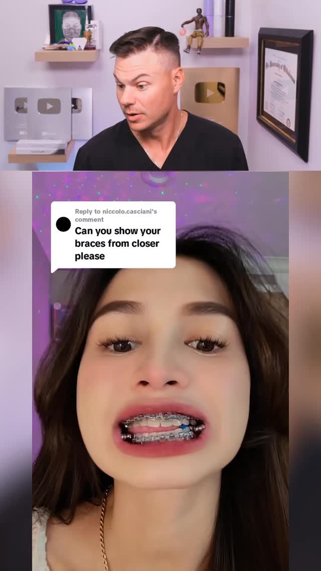 Her Teeth Are In MAXIMUM Security Jail! 😭🦷 #teeth #braces #dentist ...