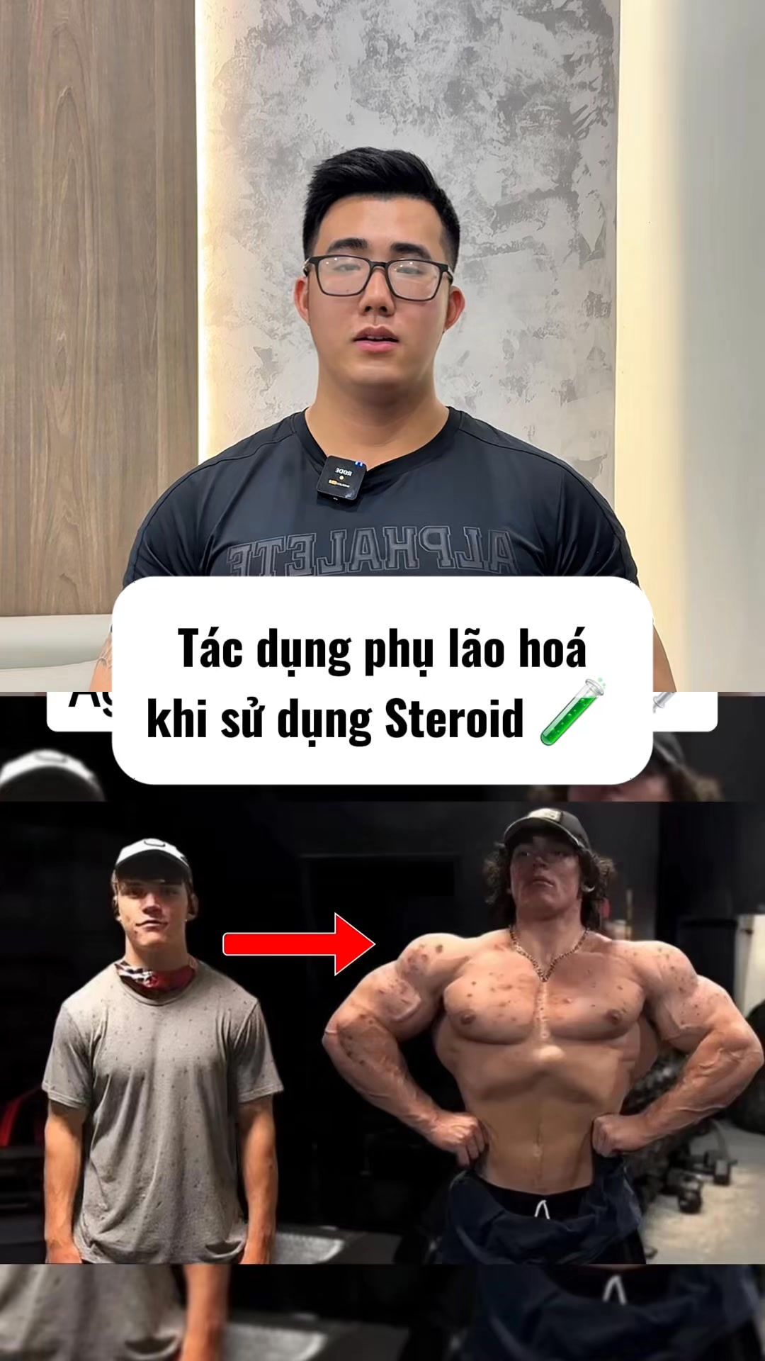 Tác dụng phụ lớn của Ste.roid 😰 #fitness #gym #gymer #workout #sport # ...