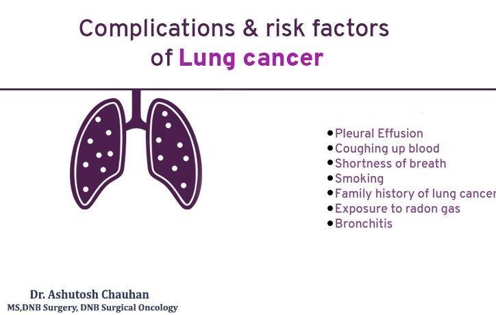 Complications & Risk Factors of Lung Cancer | Lung cancer is caused by ...