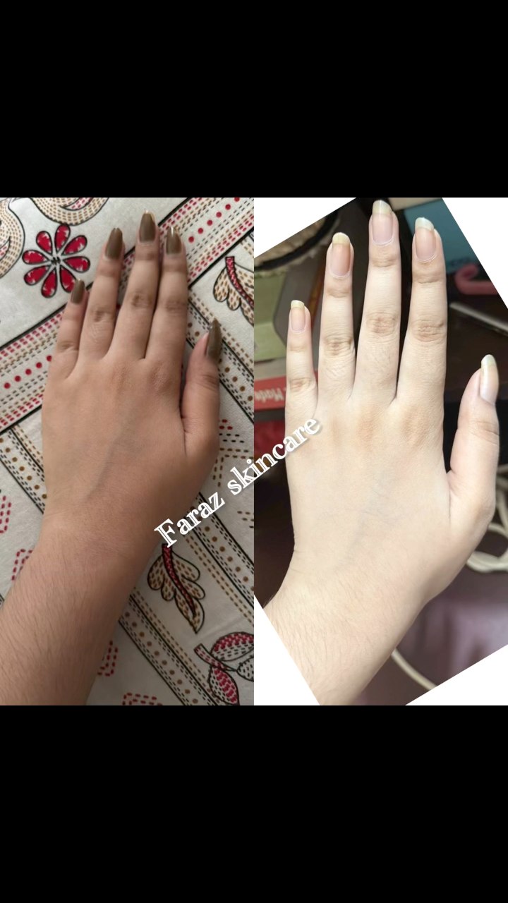 Combo 1 💖 regular price 5250 tk Discount price 4400 tk যা যা থাকবে 😊 ...