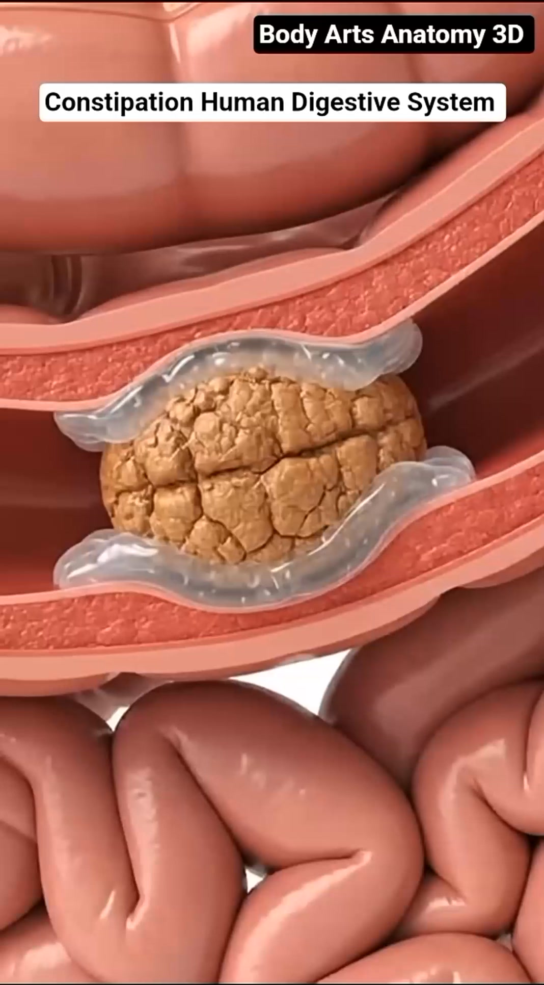 Constipation Human Digestive System Gut Health Body Arts Anatomy 3D ...