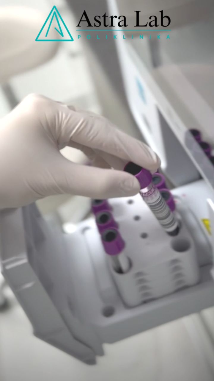 Poliklinika za laboratorijsku medicinu Astra Lab Bihać Ivana Franje ...