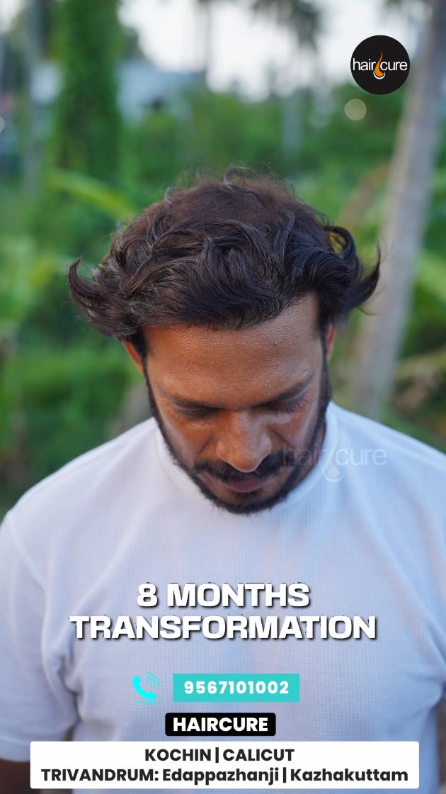 glutathione calicut 🔥 8 Months. One Incredible Transformation., The wait is over, and the results say it all. ✨, From hair loss to a fuller, natural-looking head of hair—this is what 8 months of expert planning, Size:4 Fluid Ounce Liposomal Iron – Core matrixify