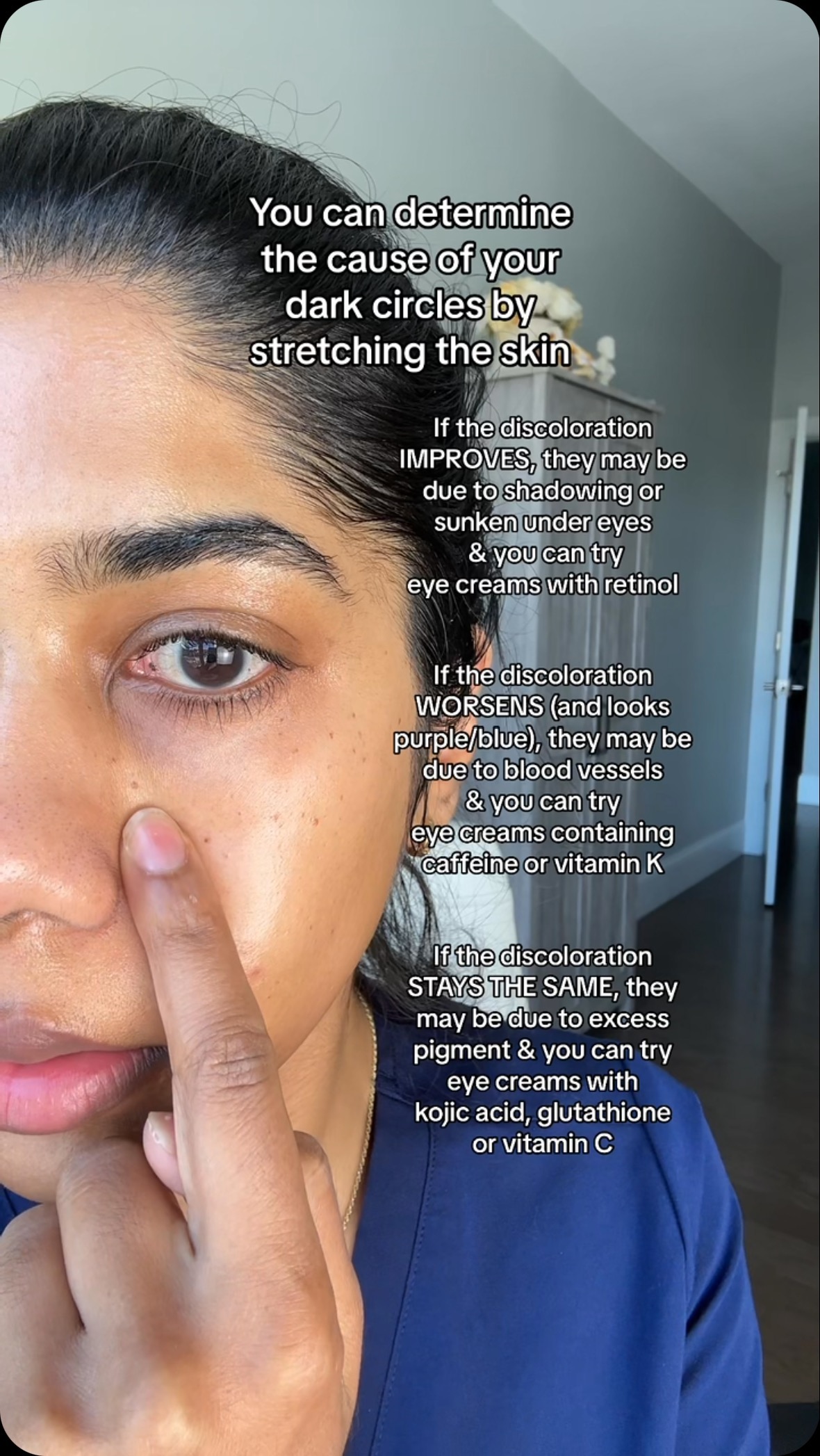 does glutathione remove dark circle 👀 Best Creams For Under Eye Circles ✨ #DarkCircles #UnderEyeCare #EyeCream #Skincare type0:Cell Viability Assays Laser Skin Resurfacing Pittsburgh Select a pack:30 DAYS PACK