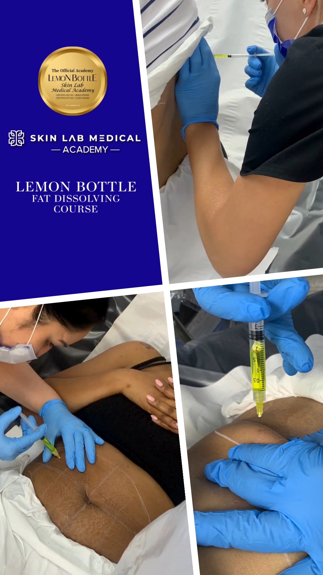lemon bottle fat dissolving training Master the art of Dissolving. 🍋, Take your aesthetics career to the next level with our hands-on Lemon Bottle Fat Course., Learn the latest techniques, gain practical Vitamin B12 and Hair Size:120 Capsules (2x60) glow eye patch