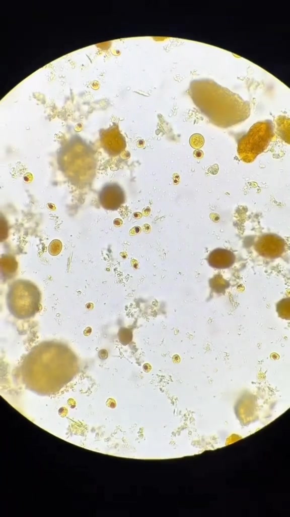 Stool sample microscopy🔬 ️ | Lab life | Facebook
