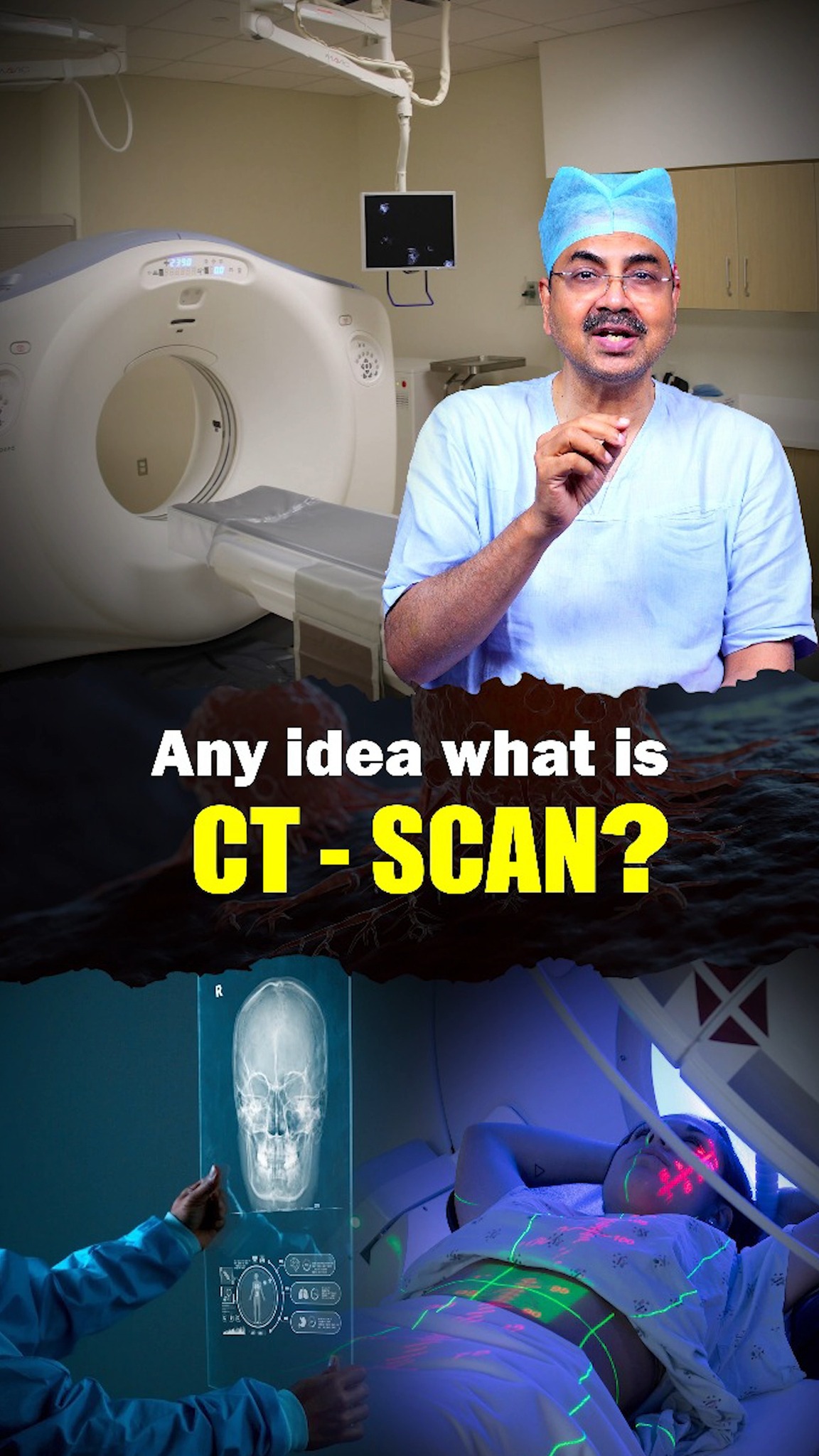 Any idea what is CT-SCAN? | Dr Mohana Vamsy Best Oncologist in ...