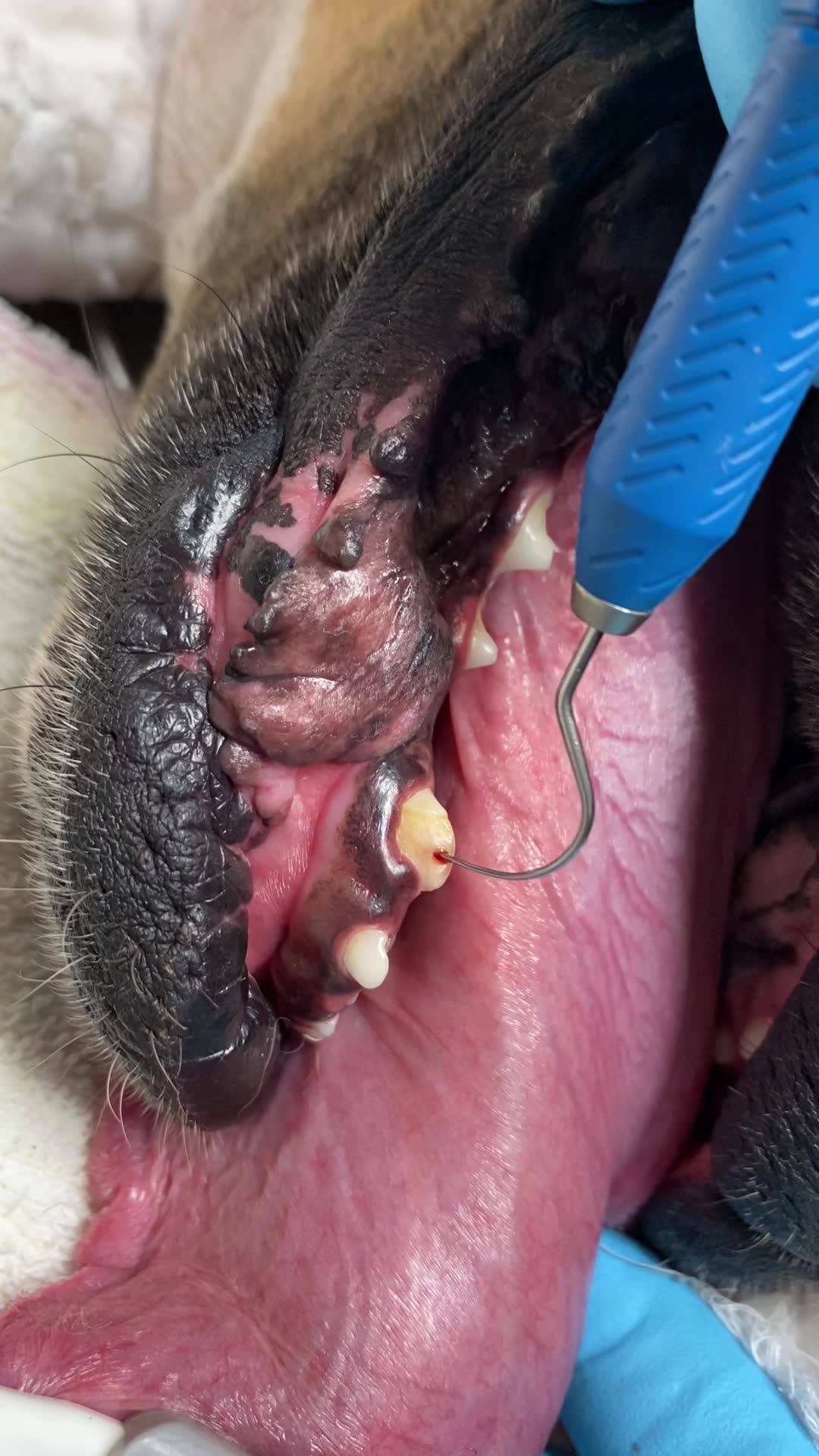 Exposed Pulp Tooth  