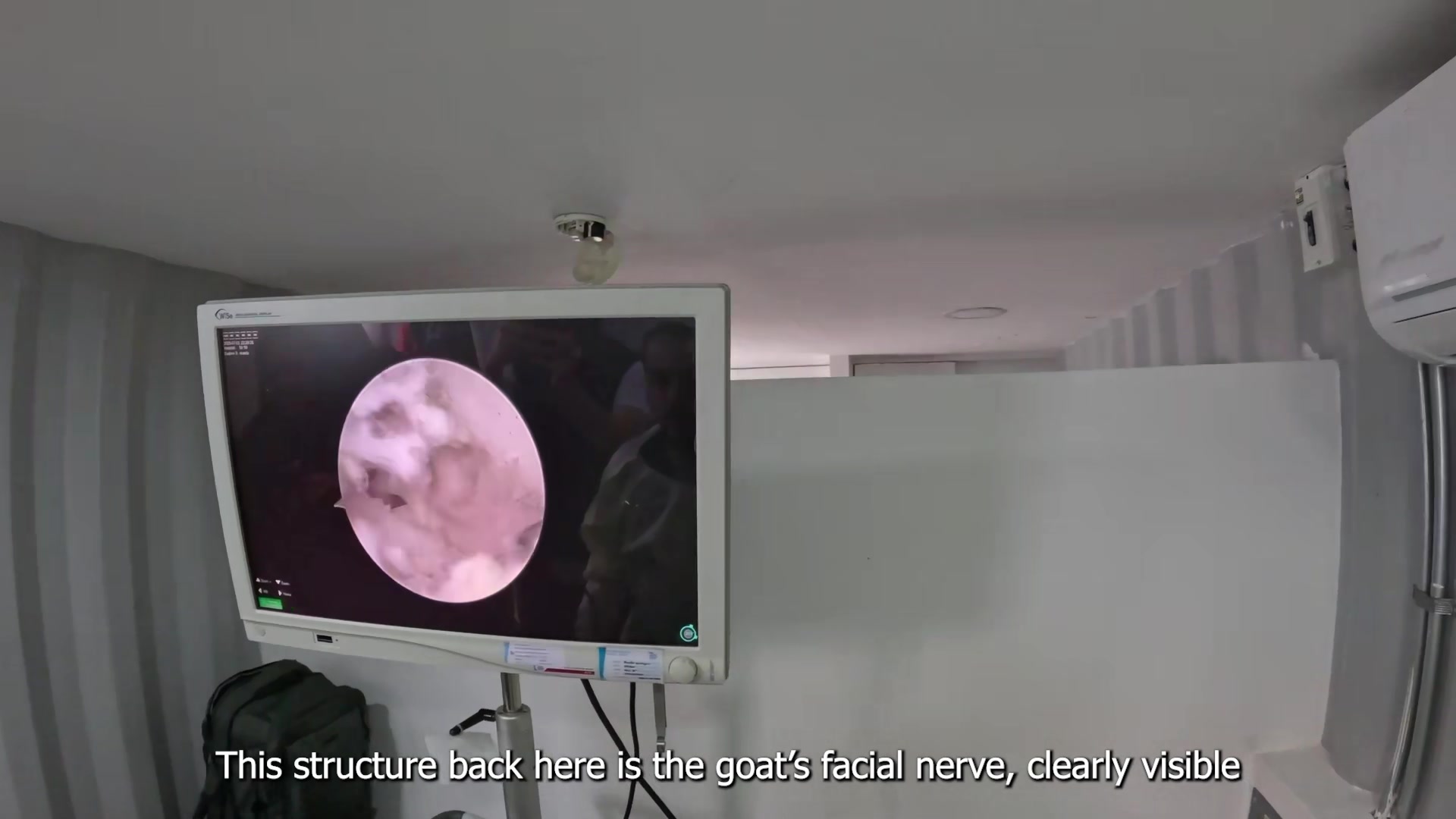 🔬 Conoce el sistema de endoscopía OTOVIEW de BONSS El lente del sistema ...