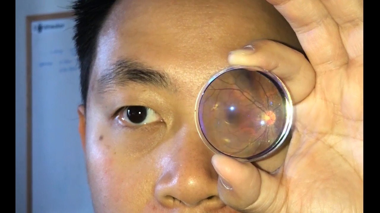 A range of affordable ophthalmic lenses from oDocs Eye Care is now ...