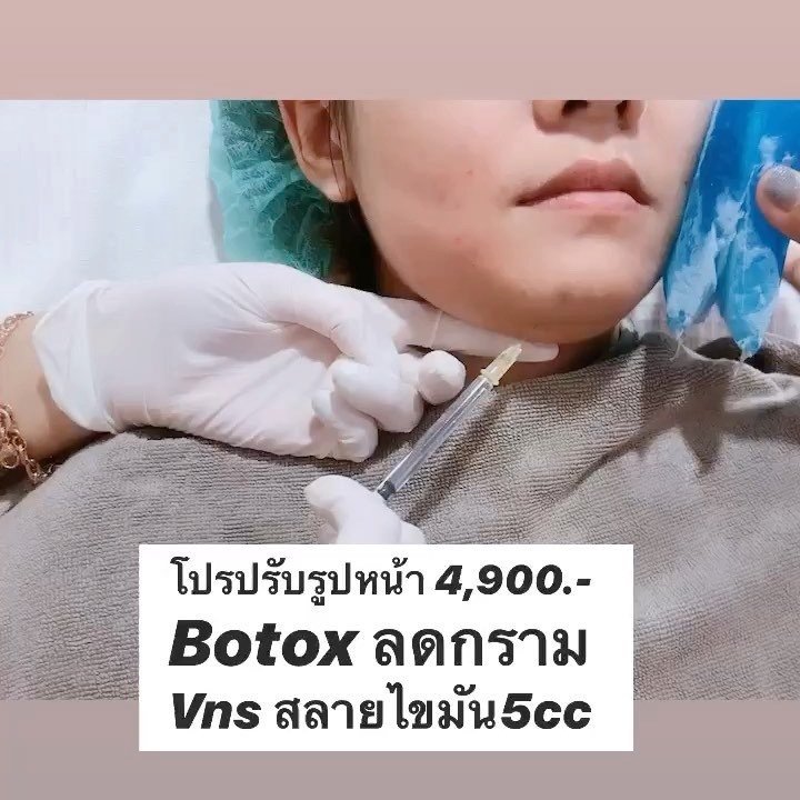 โปรปรับรูปหน้า 4,900 “เปลี่ยนหน้าบานๆให้เรียวสวยเป็นธรรมชาติ “ 🔥 ...