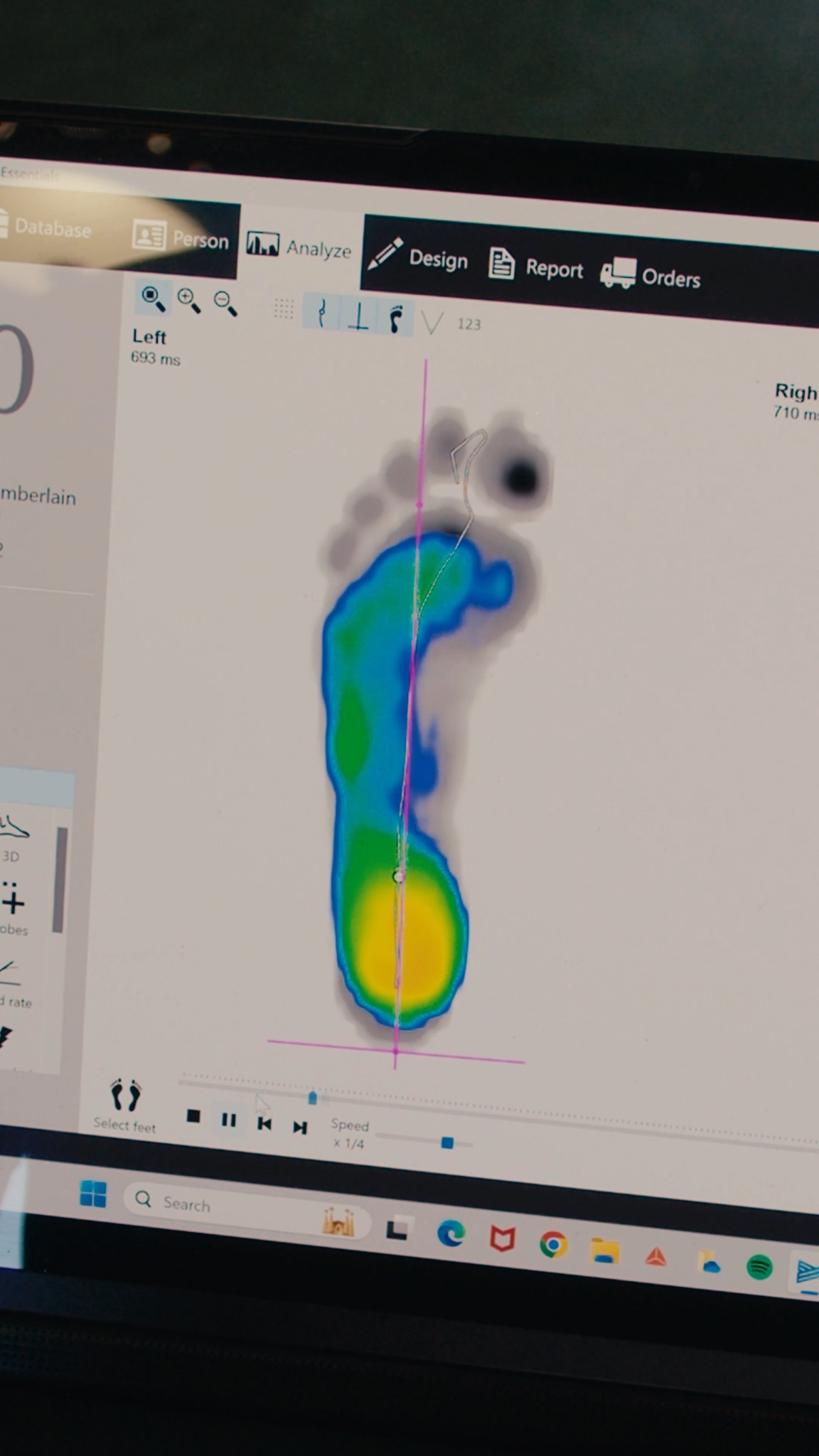 Footscan & Phits 3D Printed Orthotics 👣 | Based in Altrincham, 381 ...