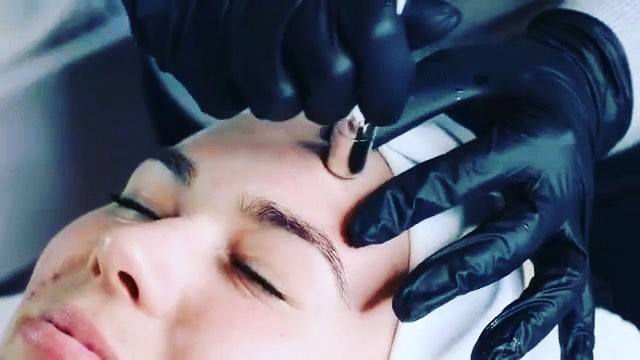 Viora's Pristine microdermabrasion device uses diamond tips (vs