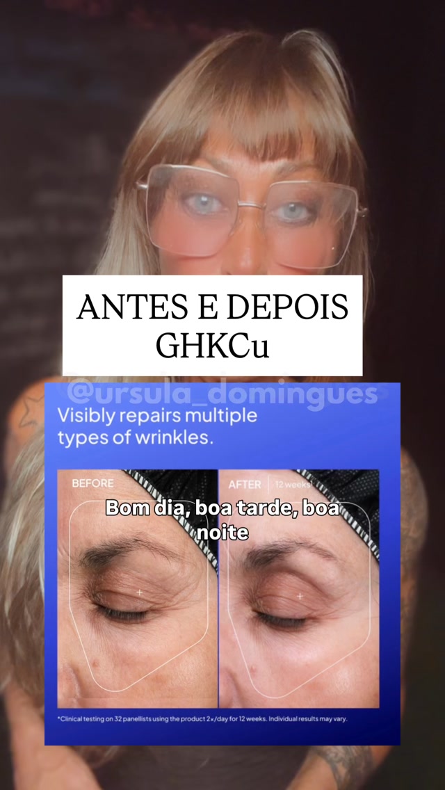 ghk-cu antes e depois Bom dia,boa tarde,boa noite! O GHK Cu é maravilhoso pode promover um verdadeiro rejuvenescimento da pele. Melhora textura, firmeza e suaviza linhas e rugas., Mas existe um limite para sua ação., GHK Peptide Therapy Guide Flyer, US- SIZE:16oz.