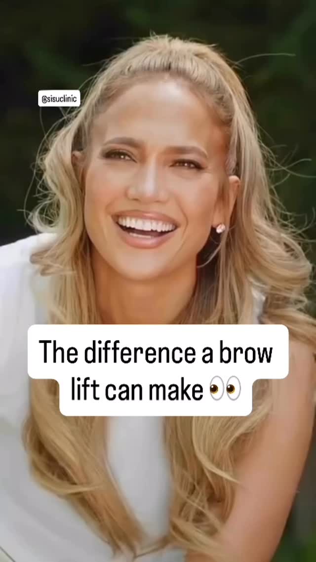 Brow Lift Benefits A subtle lift can make all the difference. With ...