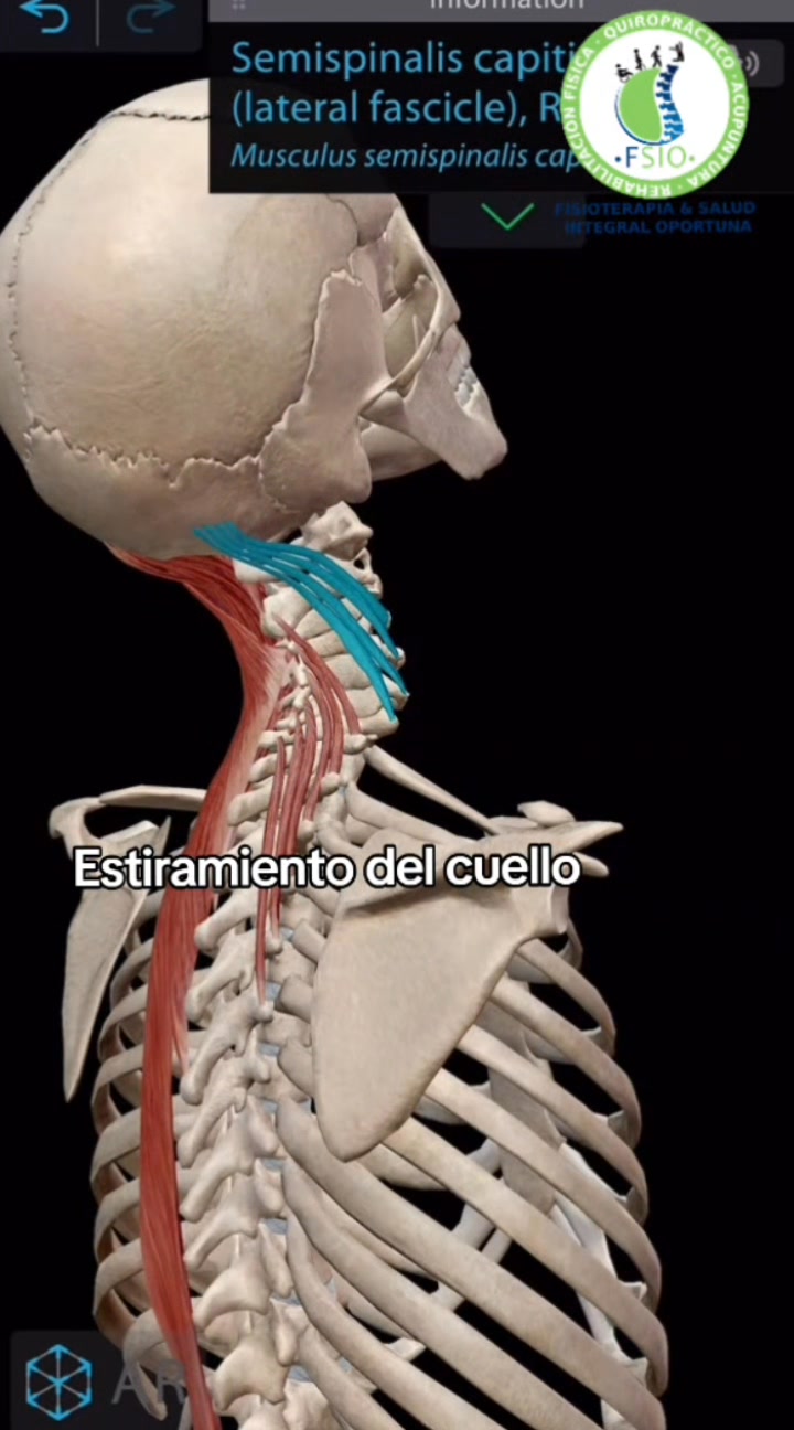 Estiramiento del cuello En FSIO tenemos variedad de tratamientos, solo ...