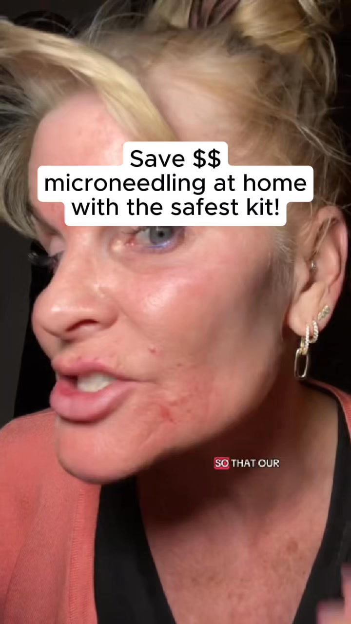 The Banish Kit 3.0 is a derm approved and top rated patented ...