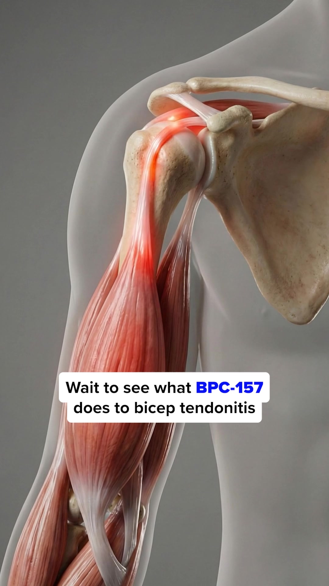bpc 157 acetate vs arginate People often ask about the difference between and forms, and the answer comes down to stability and absorption. When we're talking about oral BPC 157, th is oral bpc 157 fat-metabolism SELECT VOLUME DISCOUNT:5 PACK ~Pre-Order 8-16 week etd