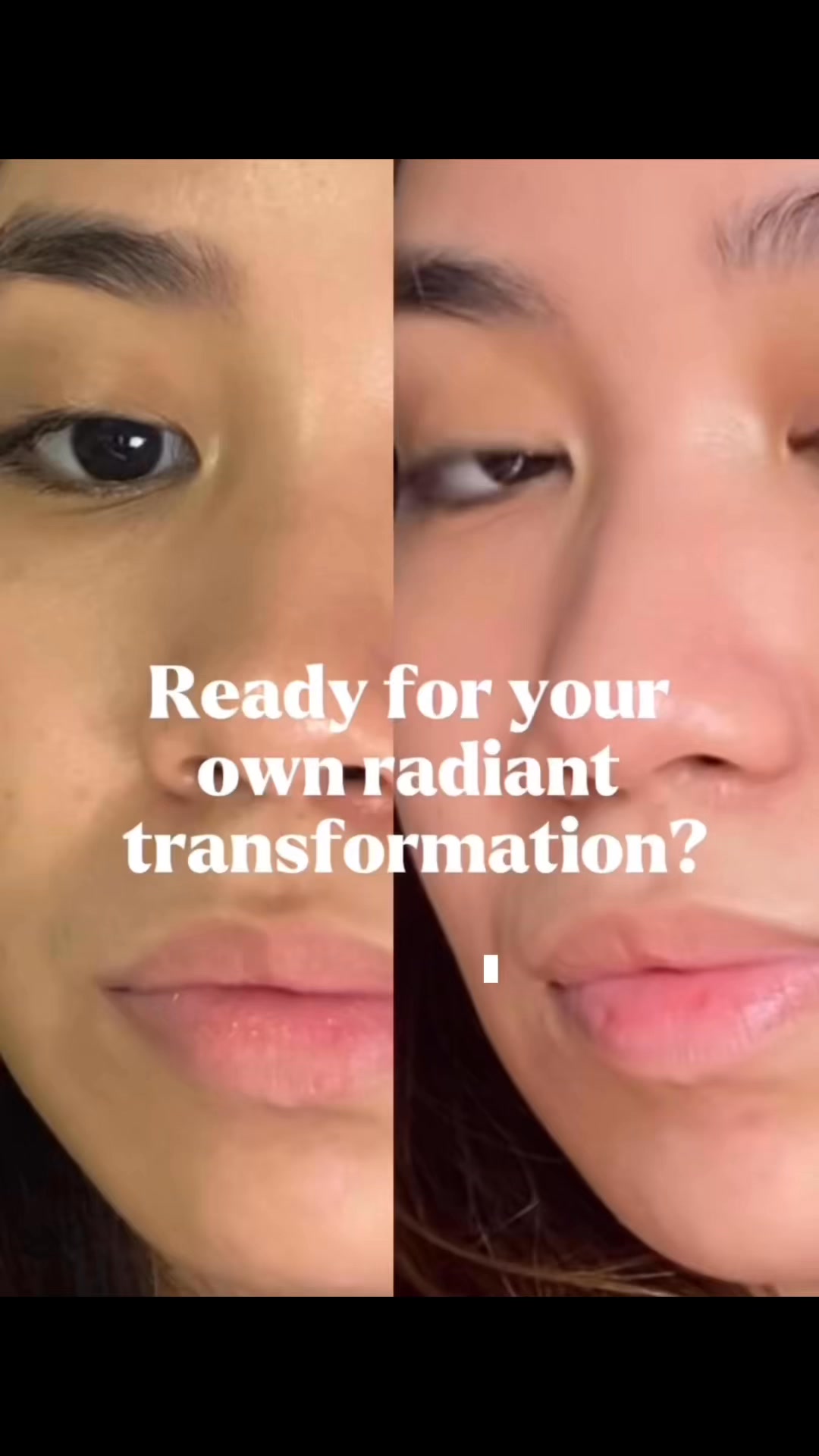 glutathione skin transformation 7-25Belo + Collagen reveals brighter, glowing with every capsule!Packed with 250mg of glutathione, it helps boost whitening and lifts wrinkles from within — giving you th Offer_page glutathione glp 1 is Style:Box (Soap x 3)