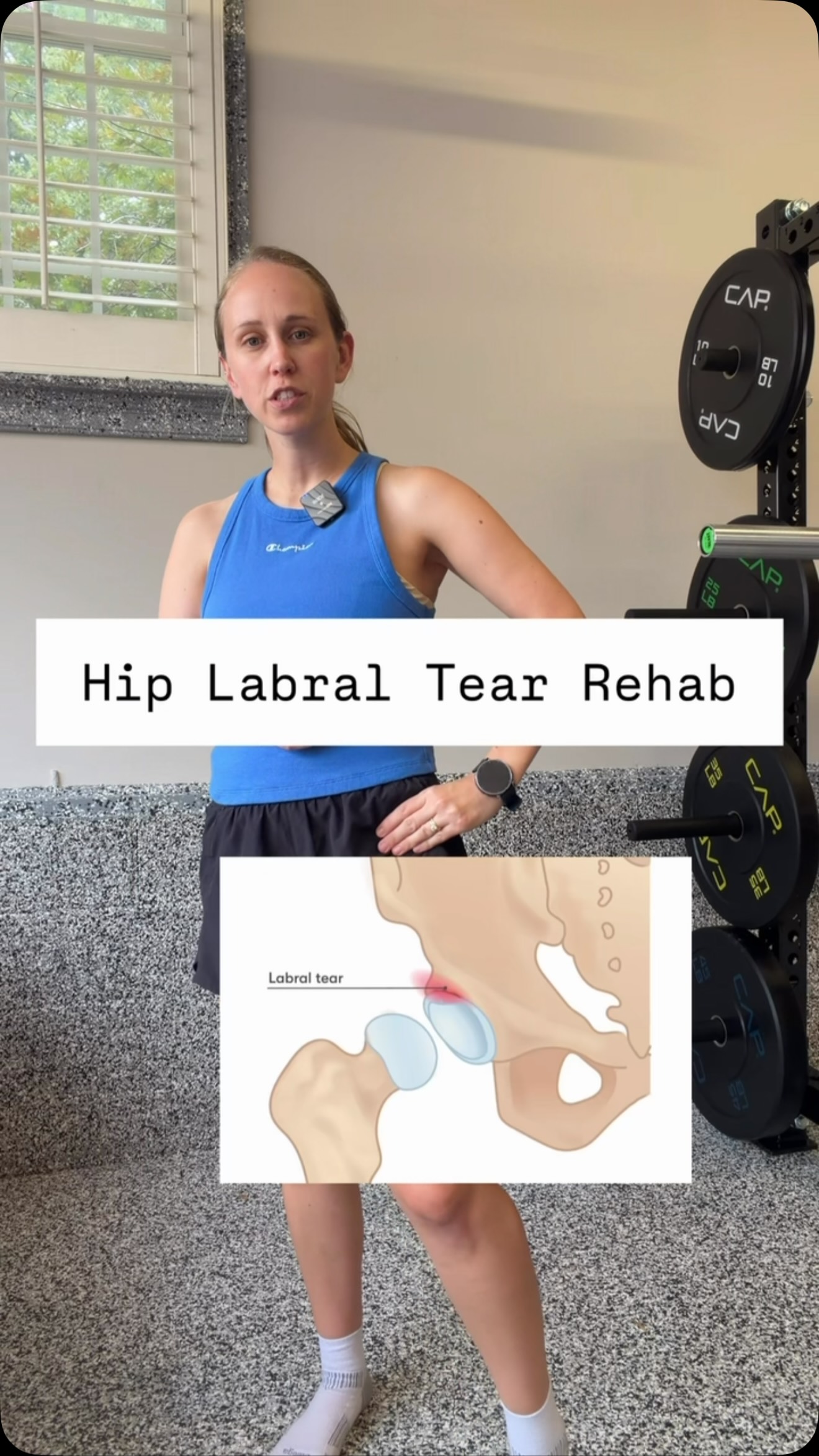 bpc 157 for hip labral tear What are alternatives to surgery healing a torn labrum? How Vitamin B-12/Lipoden & Recovery Research Vial Size:30ml Vial