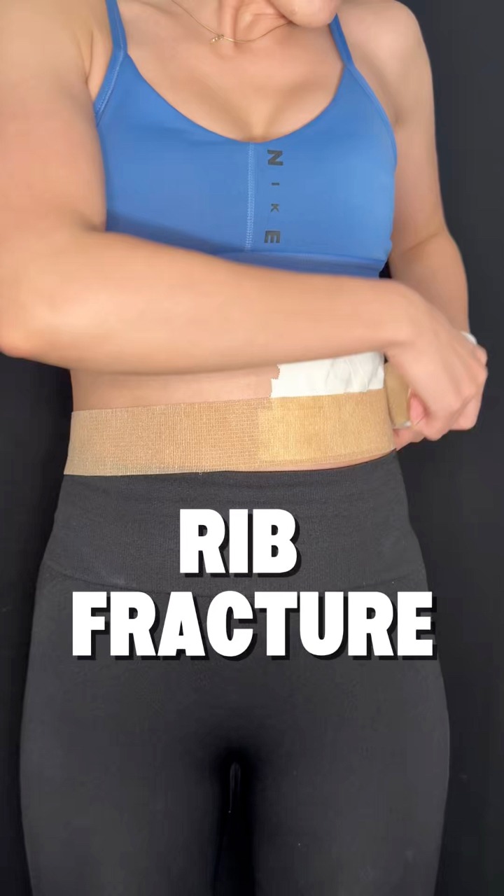 💥 Rib fracture? This taping helps stabilize the chest and reduce pain ...
