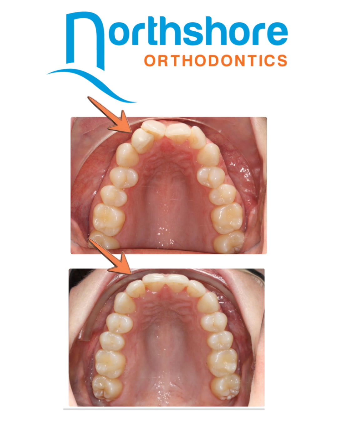 North Shore Orthodontics | North Vancouver BC