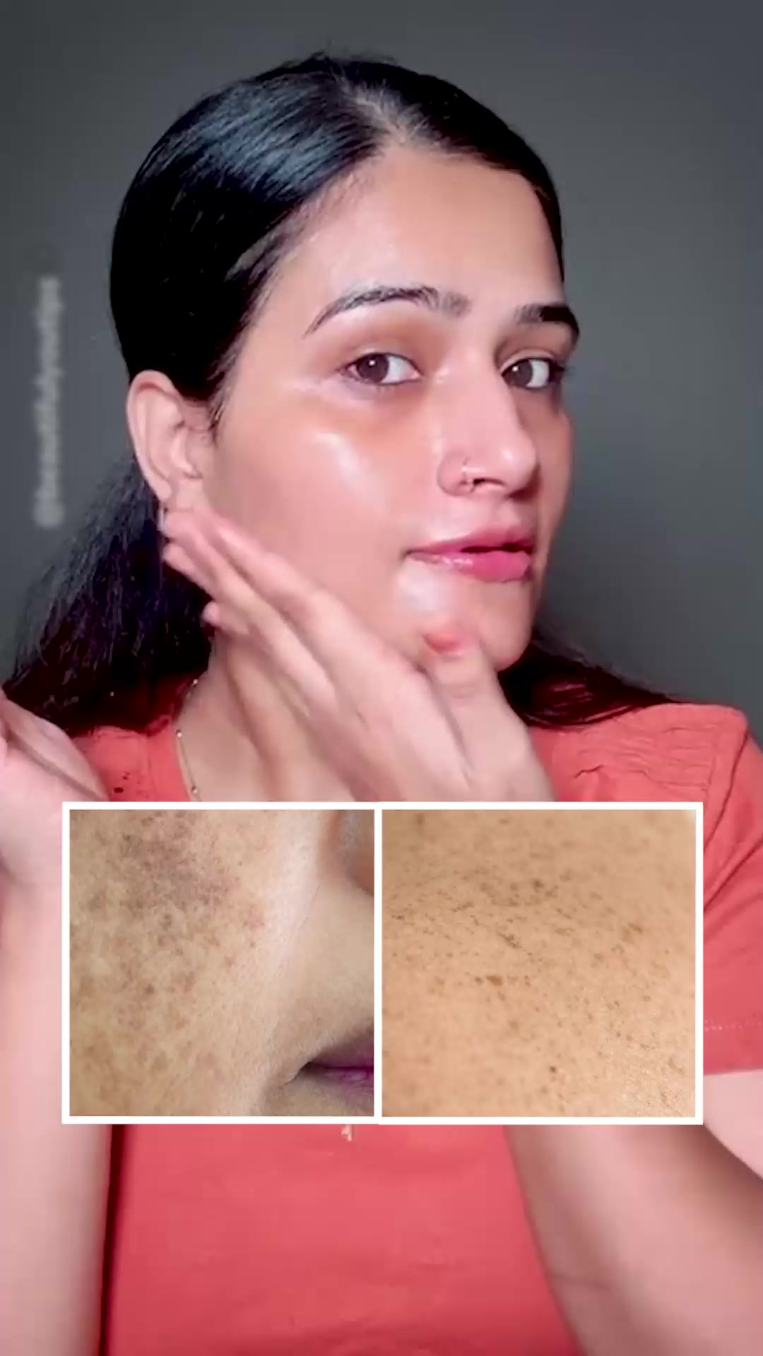 brightening serum- kojic acid & glutathione reviews Dark spots and uneven skin tone? This 2% Serum helps reduce pigmentation and gives your skin a brighter, clearer look with regular use. | Dermatouch how often should i Oily Skin Capsule Count:120