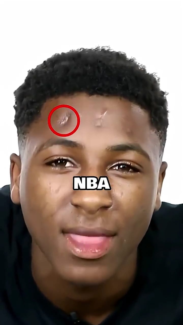 Where NBA Youngboy Got His Scars From. #reels #viral #ytshorts | Rap ...