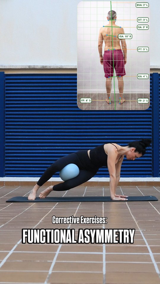 The posture analysis reveals a functional asymmetry, with a noticeable ...