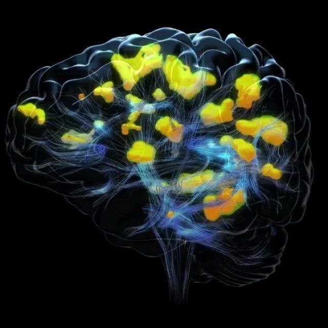 The activation of the visual cortex. A 3D animation for holographic ...