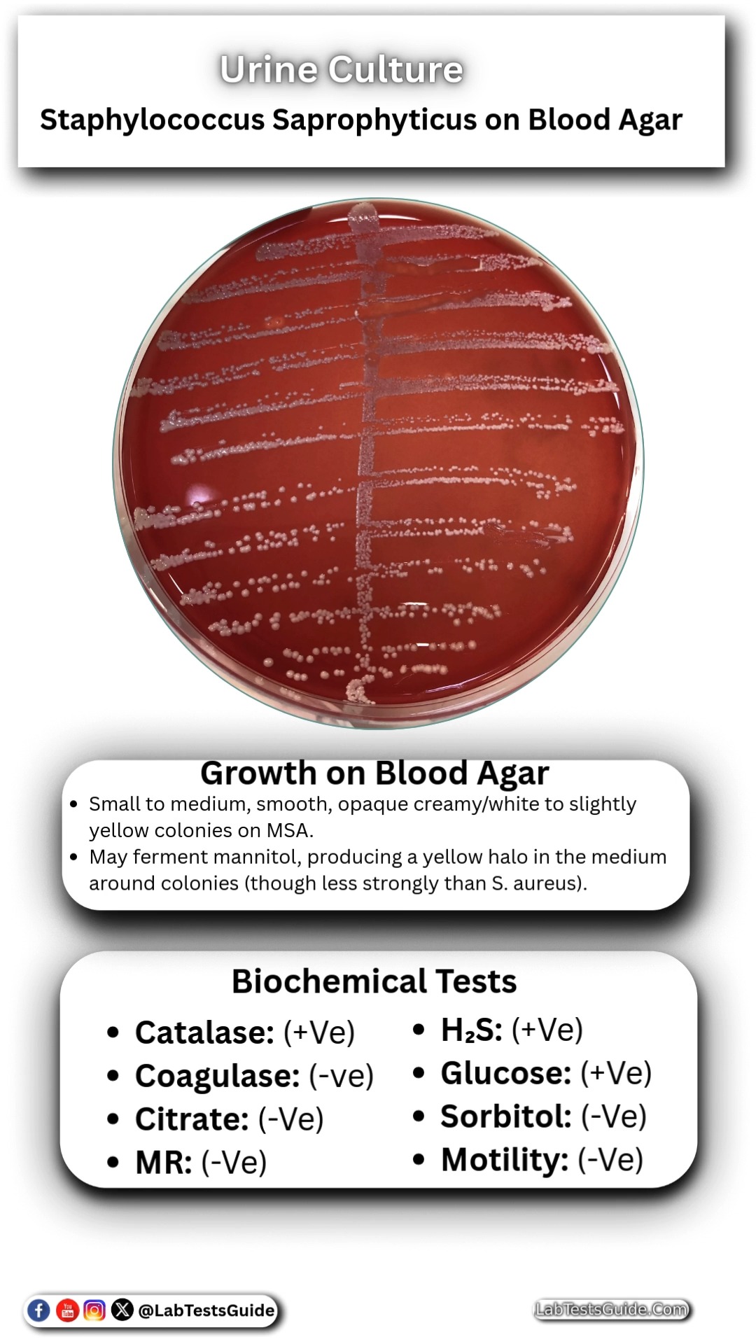 Staphylococcus Aureus on Blood Agar in Urine | Lab Tests Guide | Facebook