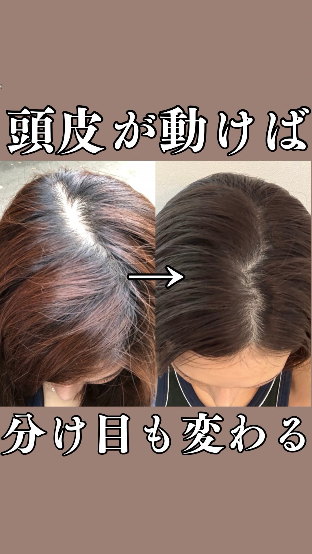 ageLOC Nutriol Scalp & Hair Serum】 今秋登場する2製品、頭皮のため