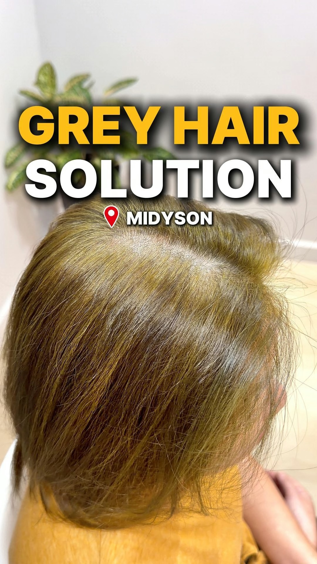 glutathione reverse grey hair ✨Grey doesn't mean you have to keep dyeing it! 👩‍🦳➡️✨, Still covering your hair with chemical hair dye every few weeks? 😣, Frequent dyeing may leave your scalp feeling sensitive and Yeast Free Ahk Cu Hair Serum Color:5RF Dark Blonde Flaming Red
