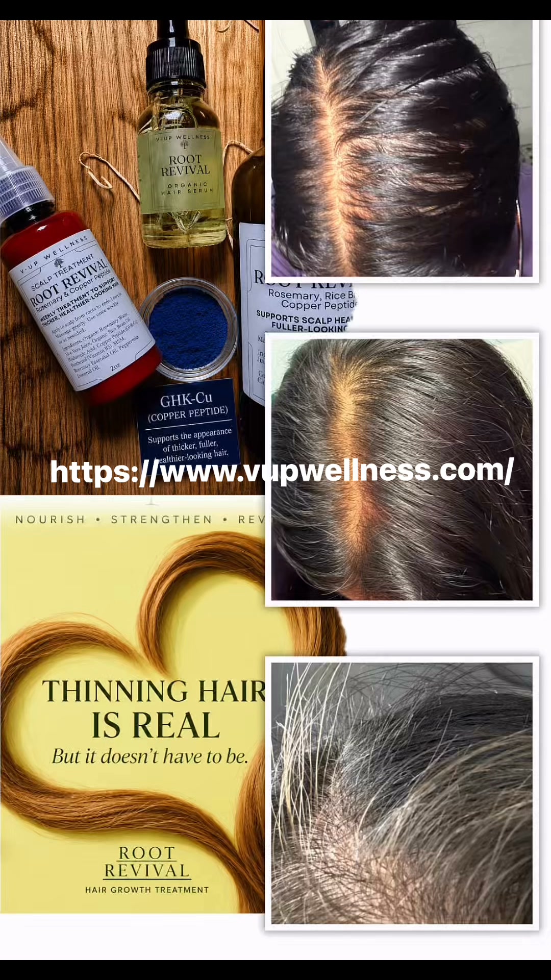 Real women. Real results. , Thinning hair is real—but it doesn’t have to be your new normal., These are real results from women in our V-Up Wellness community using Root Revival Peptide Hair 