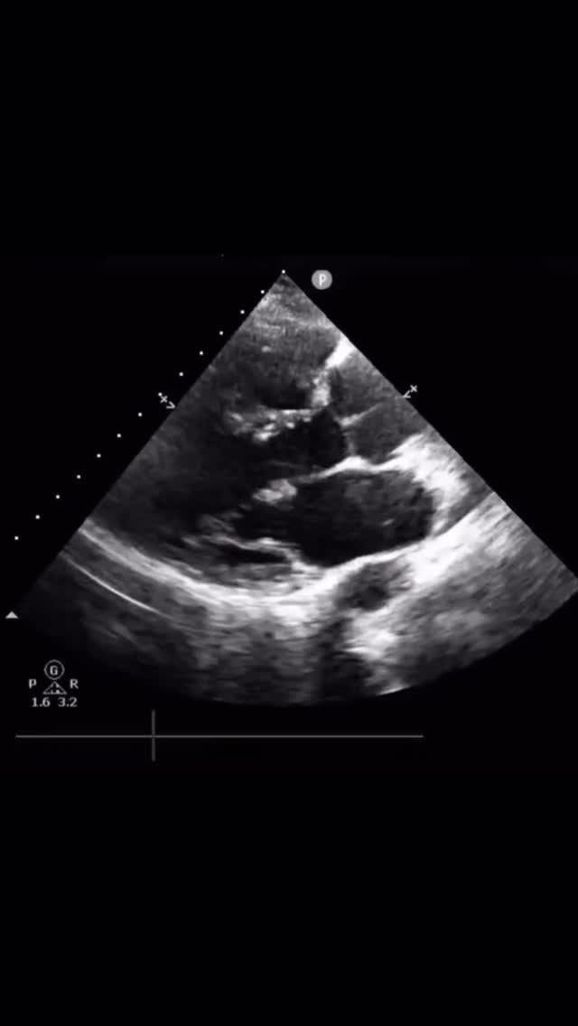 ECHOLOGISTS - RVSP via VSD Flow — Let’s Break Down The... | Facebook