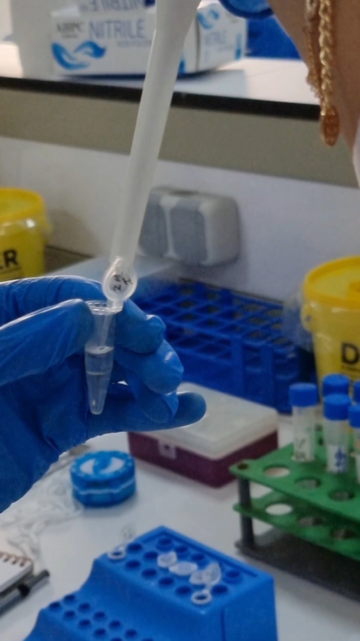 Molecular Biology Workshop: Agarose Gel Electrophoresis | Molecular ...