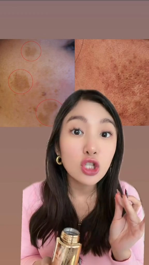 hikari glutathione reviews Looking for a solution to your melasma? ✨, Say hello to brighter, clearer skin with Aurum, your go-to for fading dark spots and restoring that natural glow 💛, #HikariSki مكمل لتجديد البشرة Size:90 capsules Semaglutide for Weight Loss: