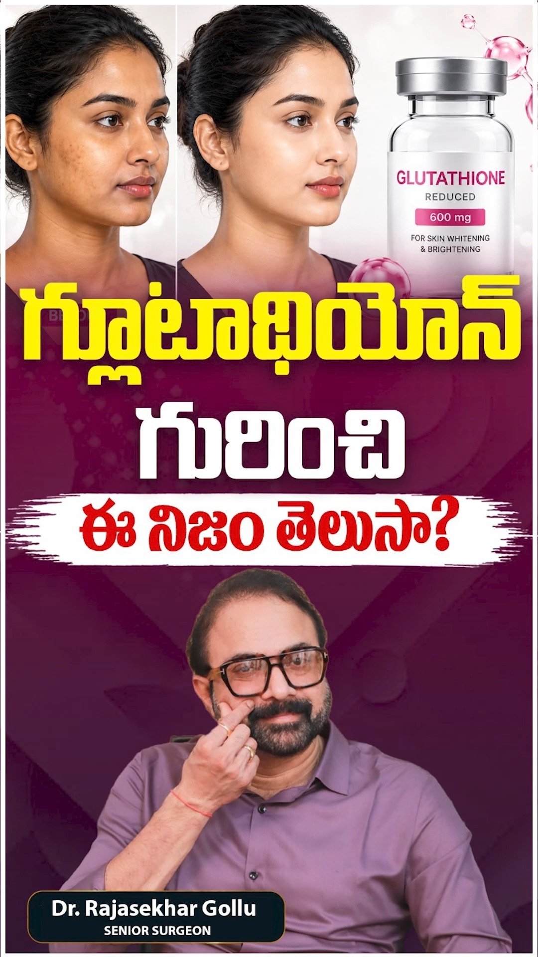 glutathione whitening pills in johannesburg Does Really Whiten Your Skin? Here's the Truth! 😲 | Glutathione Skin Telugu Ameliorating Effects of Natural climate_sunny Bundle Frequency:4 Month