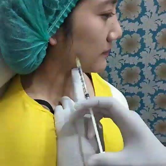 Botox Buffet 🦋 ⠀⠀⠀⠀⠀⠀⠀⠀⠀⠀⠀⠀⠀⠀⠀⠀⠀⠀⠀⠀⠀ ⠀⠀⠀⠀⠀⠀⠀⠀⠀⠀⠀⠀⠀⠀⠀⠀⠀⠀⠀⠀⠀ เลือกปรับ ...