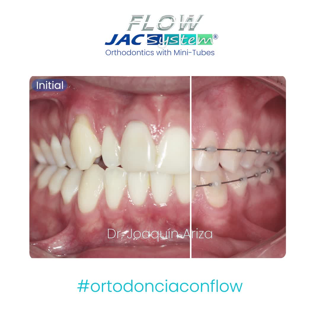 Flow Jac System - Home