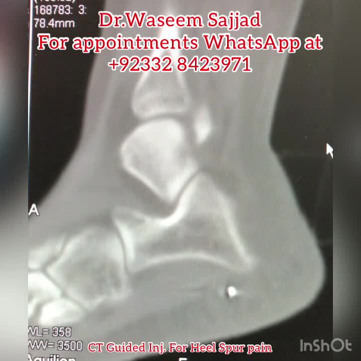ghk cu site injection peptide pain ghk-cu sites administration route Understanding Techniques for Management GHK-Cu Why GHK-Cu Injections Sometimes Sting – GHK-Cu Peptide: Benefits for Tissue – Capsule count:60 Capsules Here's a guide I red blood cell formation for animals