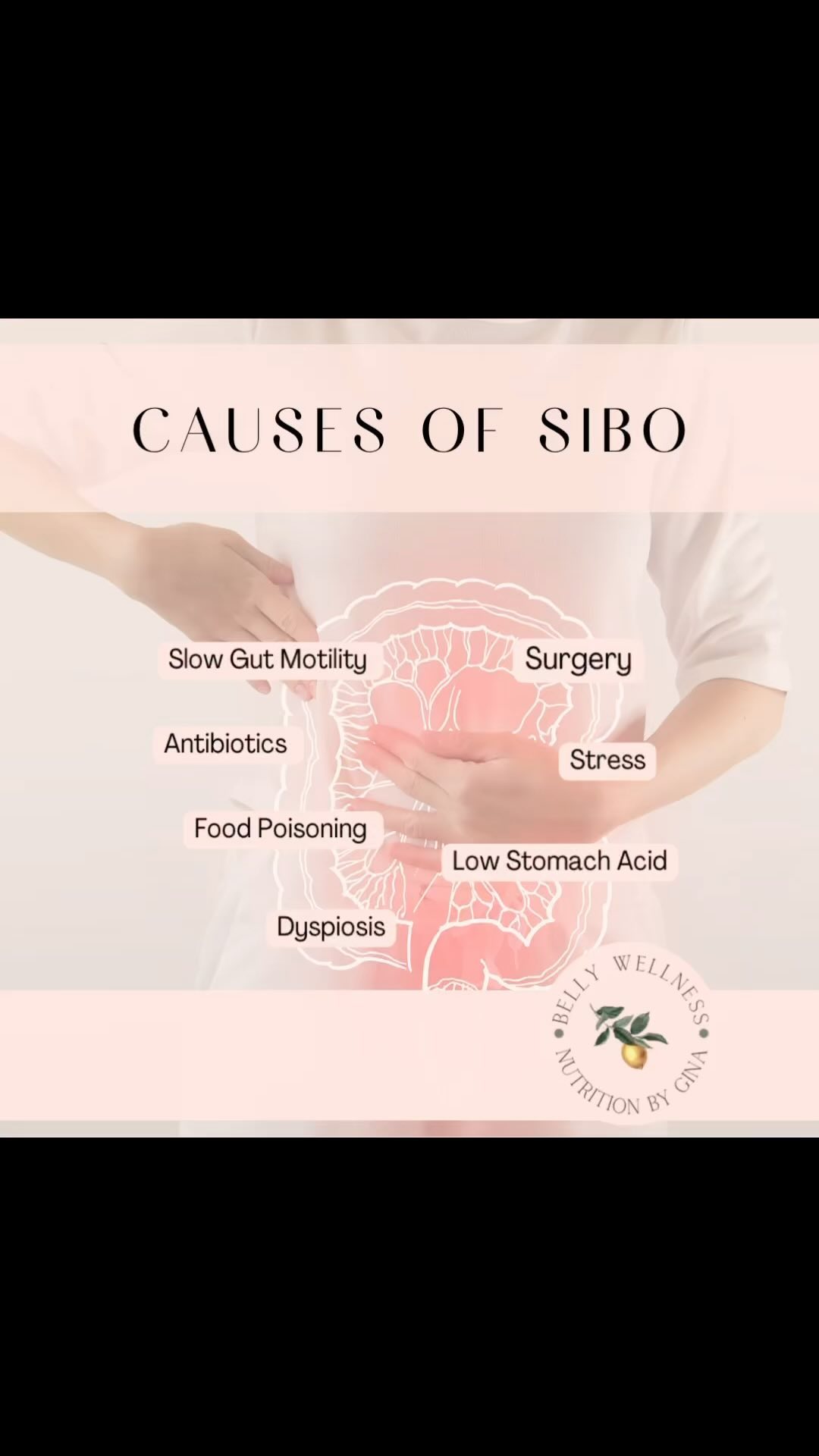 Can being on a GLP-1 medication cause SIBO?