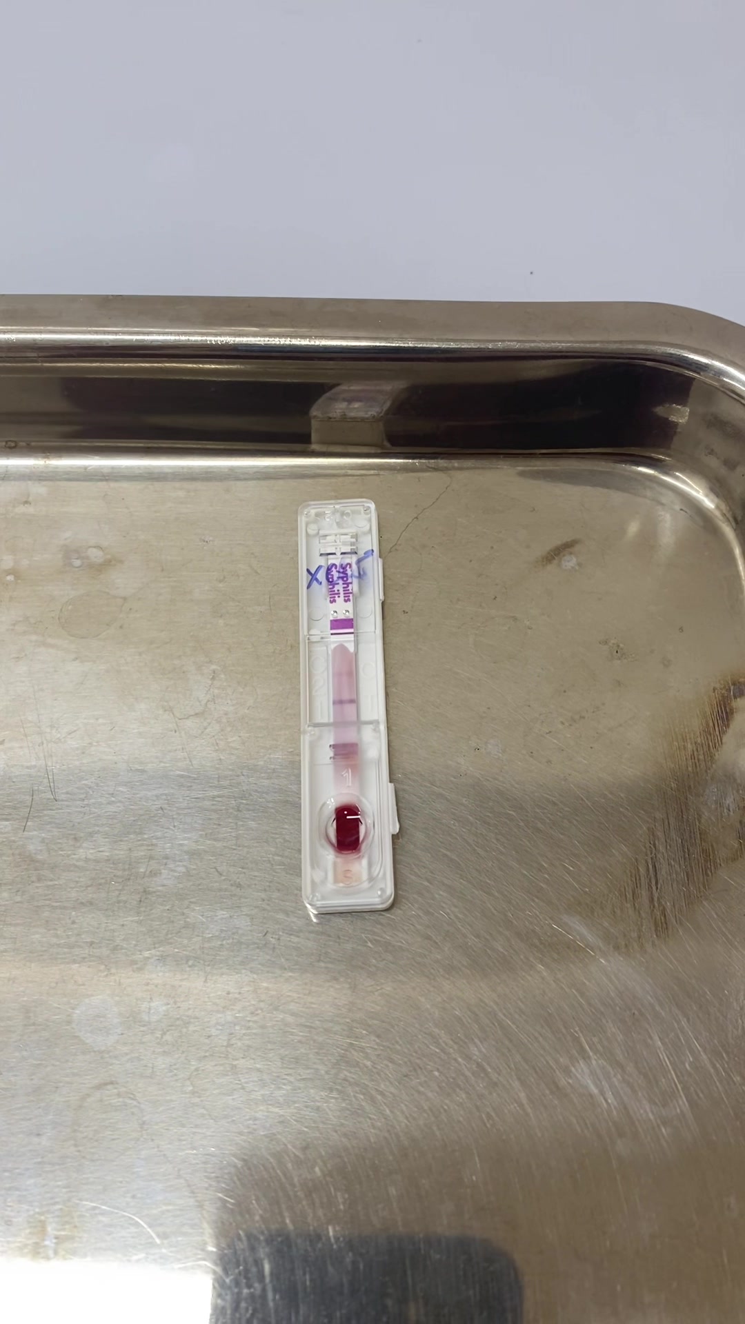 HIV ALO TEST | Ho Chi Minh City