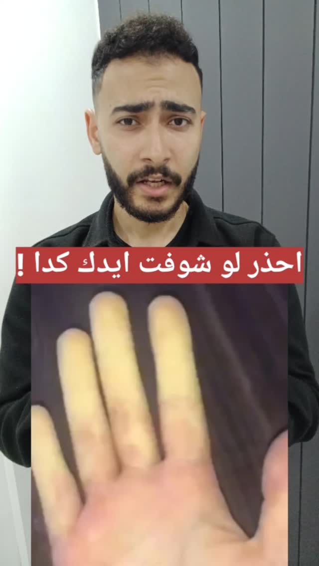 احذر لو شوفت ايدك كدا ! #خد_تعالي_اقولك | Ahmed Magdy | Facebook