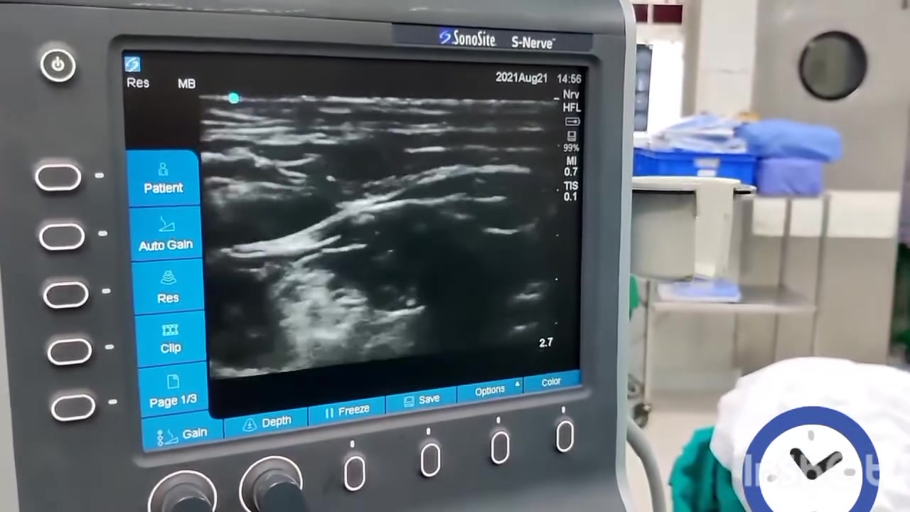 Ultrasound Guided Interscalene Bracheal Plexus Block | Khalid's ...