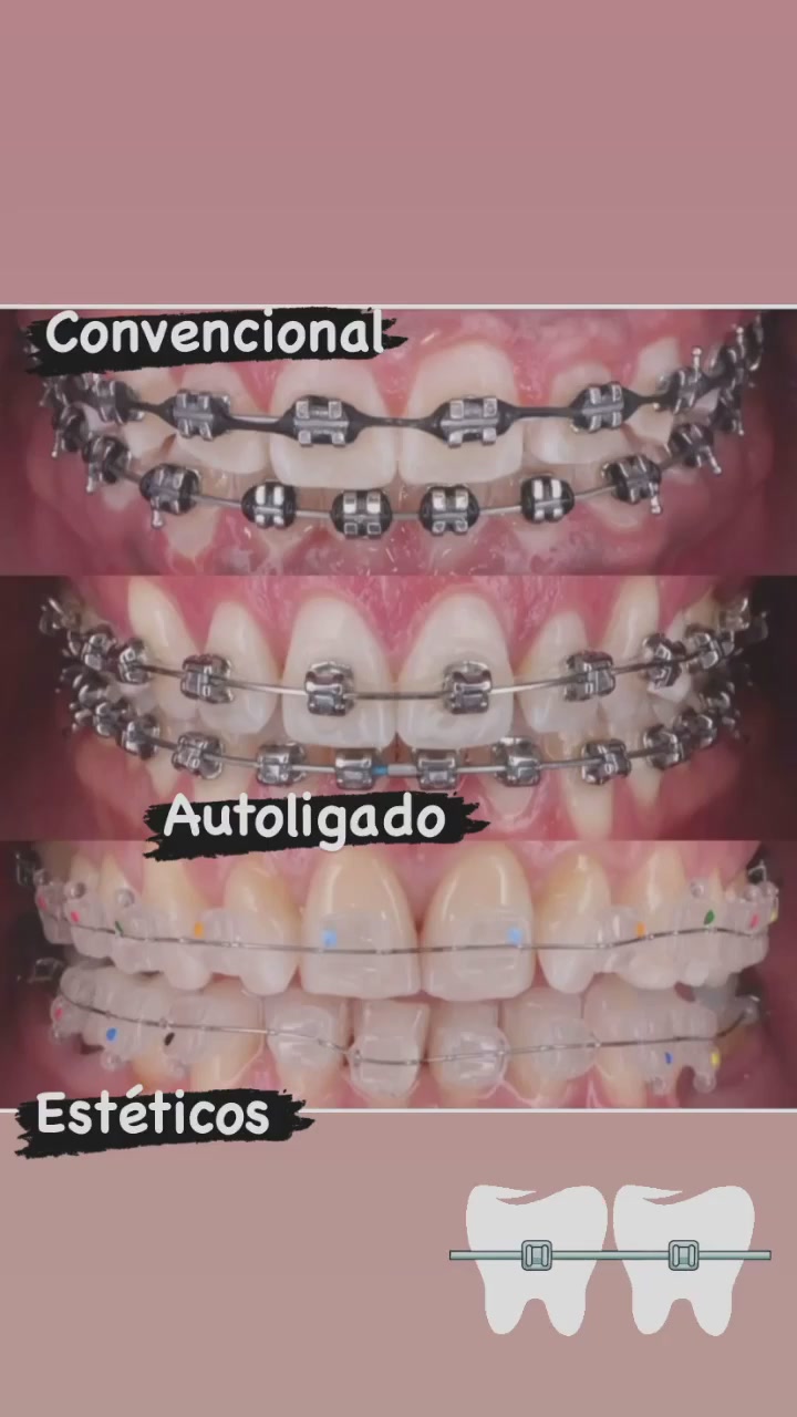 Ges Dental Odontología Integral | Santiago de Cali