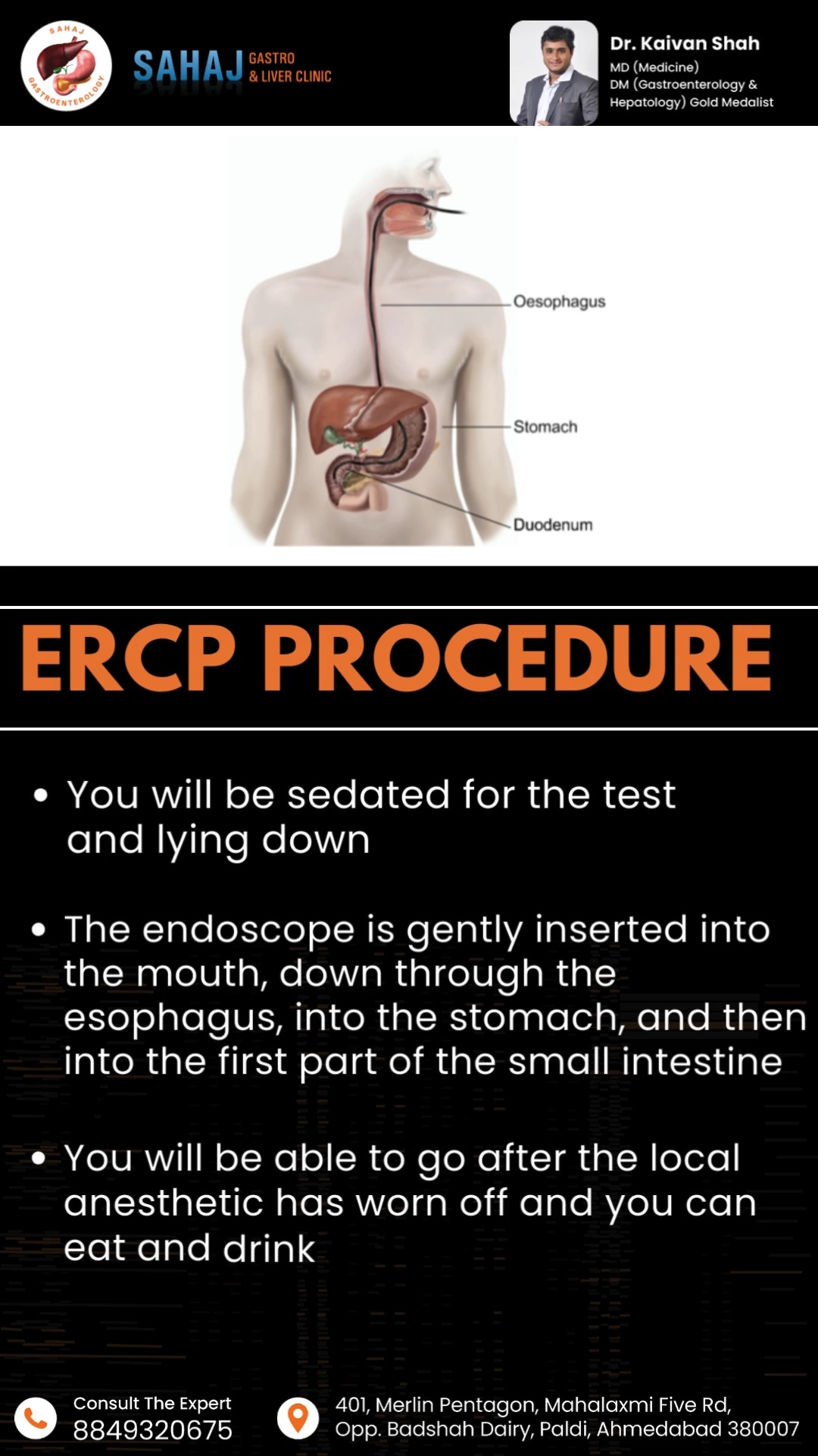 🌟 Understanding ERCP: A Life-Saving Procedure! 🌟 👩‍⚕️👨‍⚕️ Have you ...